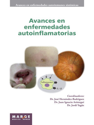 cover image of Avances en enfermedades autoinflamatorias